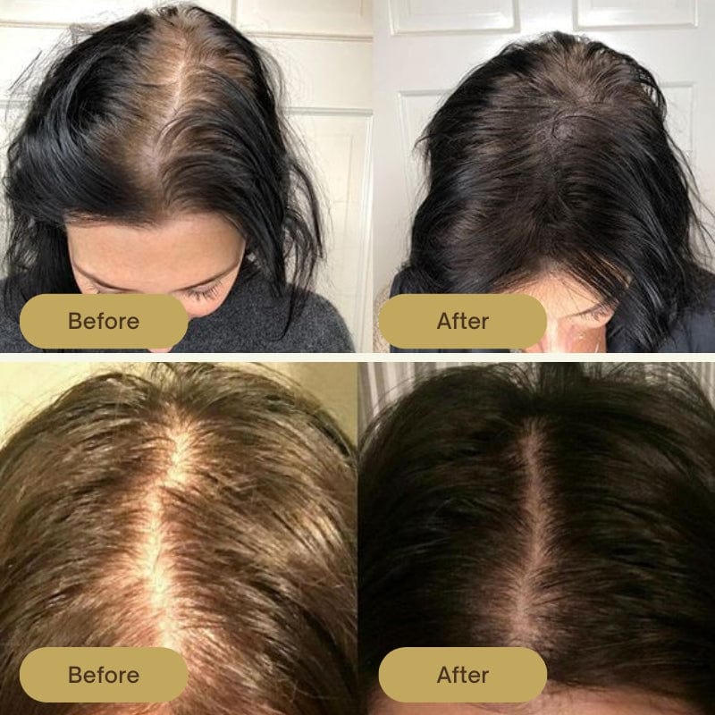 🌿 Huile de Batana – Le secret ancestral pour des cheveux forts et sublimes !