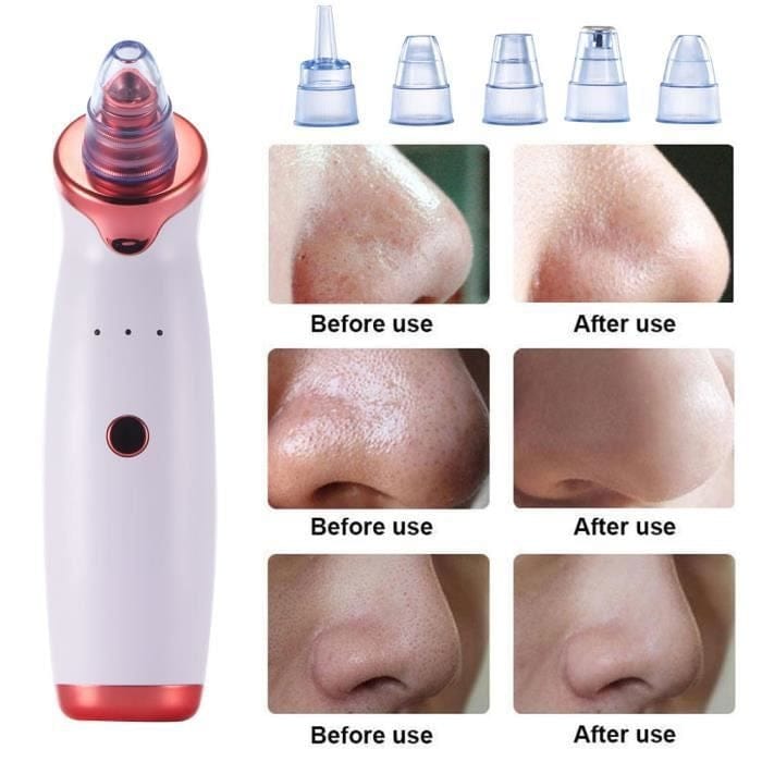 Aspirateur de Graisses & Points Noirs