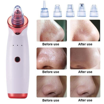 Africa online store Aspirateur de Graisses & Points Noirs Aspirateur de Graisses & Points Noirs