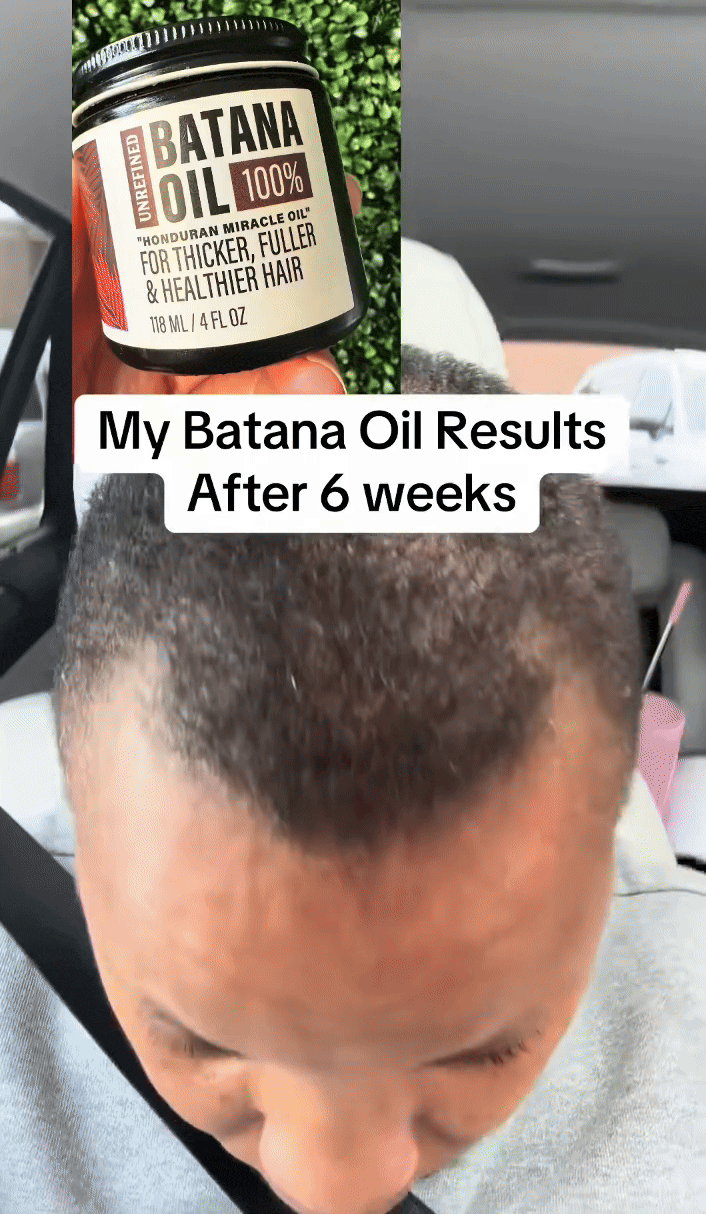 🧔‍♂️🔥 Kit Batana Homme – Anti-Calvitie & Boosteur de Barbe